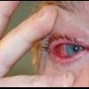 pyfocal